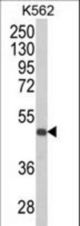 Western blot of KIR3DS1 Antibody in K562 cell line lysates (35 ug/lane). KIR3DS1 (arrow) was detected using the purified antibody.