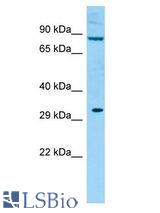 KIRREL2 / FILTRIN antibody Western Blot of Rat Testis. Antibody dilution: 1 ug/ml.