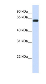 KIRREL2 antibody LS-C102353 Western blot of Fetal Liver lysate.
