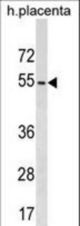 KIRREL2 Antibody western blot of human placenta tissue lysates (35 ug/lane). The KIRREL2 antibody detected the KIRREL2 protein (arrow).