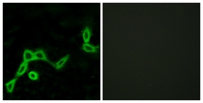 Immunofluorescence of LOVO cells, using KISS1R Antibody. The picture on the right is treated with the synthesized peptide.