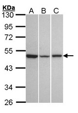 Sample (30 ug of whole cell lysate). A: A431. B: Hela. C: Hep G2. 10% SDS PAGE. KISS1R antibody diluted at 1:1000.
