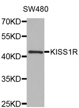 Western blot analysis of extracts of SW480 cell line, using KISS1R antibody.