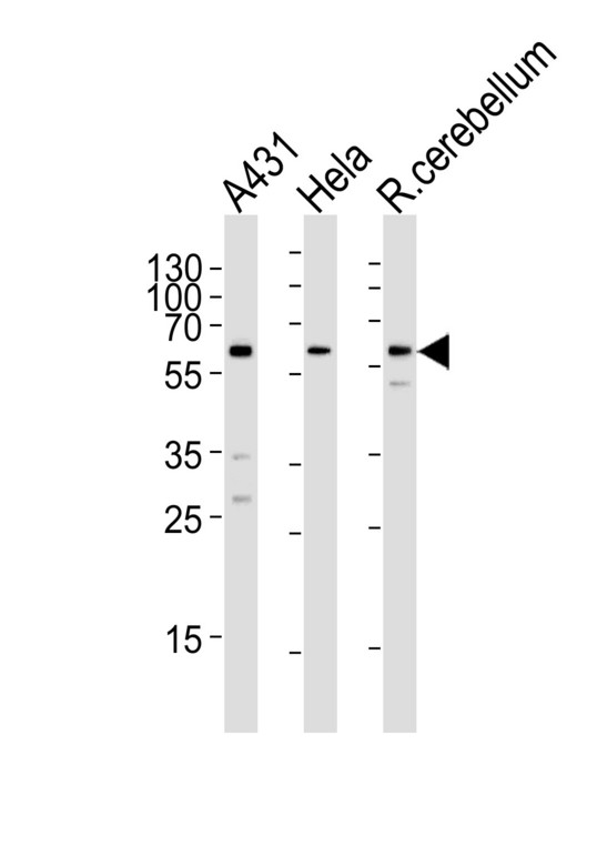 Western blot of lysates from A431, HeLa cell line and rat cerebellum tissue lysate (from left to right), using KISS1R Antibody. Antibody was diluted at 1:1000 at each lane. A goat anti-rabbit IgG H&L (HRP) at 1:5000 dilution was used as the secondary antibody. Lysates at 35ug per lane.