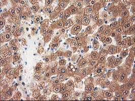 IHC of paraffin-embedded Human liver tissue using anti-GRHPR mouse monoclonal antibody.