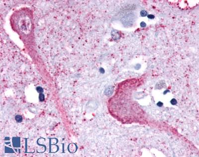 Anti-KISS1R / GPR54 antibody LS-A1929 IHC of human brain, neurons and glia. Immunohistochemistry of formalin-fixed, paraffin-embedded tissue after heat-induced antigen retrieval.