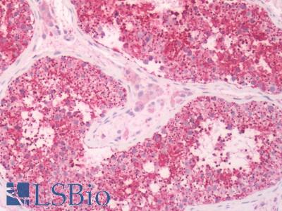 Human Testis: Formalin-Fixed, Paraffin-Embedded (FFPE)