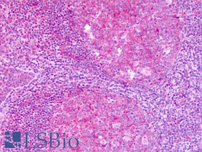 Anti-KISS1R / GPR54 antibody IHC of human tonsil. Immunohistochemistry of formalin-fixed, paraffin-embedded tissue after heat-induced antigen retrieval. Antibody LS-A1928 dilution 3-5 ug/ml.