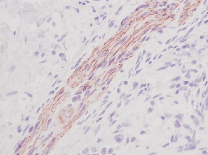 IHC of SCF antibody LS-C104667