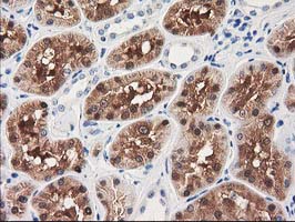 IHC of paraffin-embedded Human Kidney tissue using anti-GRHPR mouse monoclonal antibody.