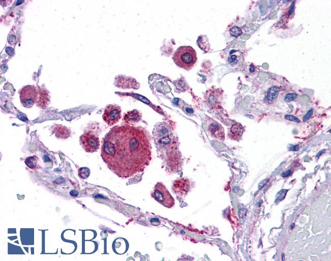 Anti-KITLG / SCF antibody IHC of human lung. Immunohistochemistry of formalin-fixed, paraffin-embedded tissue after heat-induced antigen retrieval. Antibody LS-B4658 concentration 5 ug/ml.
