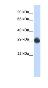 KITLG / SCF antibody LS-B4658 Western blot of HepG2 cell lysate.