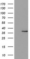 HEK293T cells were transfected with the pCMV6-ENTRY control (Left lane) or pCMV6-ENTRY GRHPR (Right lane) cDNA for 48 hrs and lysed. Equivalent amounts of cell lysates (5 ug per lane) were separated by SDS-PAGE and immunoblotted with anti-GRHPR.