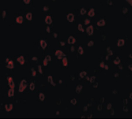 Immunofluorescence of SCF in Human Brain cells with SCF antibody at 20 ug/ml.