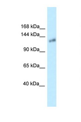 KL / Klotho antibody LS-C145689 Western blot of Small Intestine lysate. Antibody concentration 1 ug/ml.