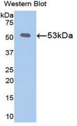 Western blot of recombinant KL / Klotho.