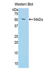 Western blot of recombinant KL / Klotho.