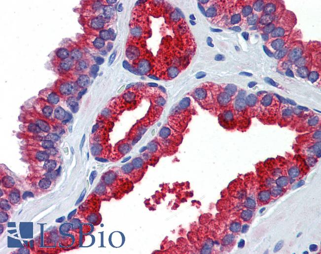Anti-Klotho antibody IHC of human prostate. Immunohistochemistry of formalin-fixed, paraffin-embedded tissue after heat-induced antigen retrieval. Antibody LS-B5728 concentration 5 ug/ml.