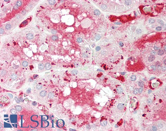 Human Kidney: Formalin-Fixed, Paraffin-Embedded (FFPE)