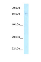 KLC2 antibody LS-C145728 Western blot of MCF7 Cell lysate. Antibody concentration 1 ug/ml.
