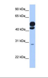 Fetal brain lysate. Antibody concentration: 1.0 ug/ml. Gel concentration: 12%.