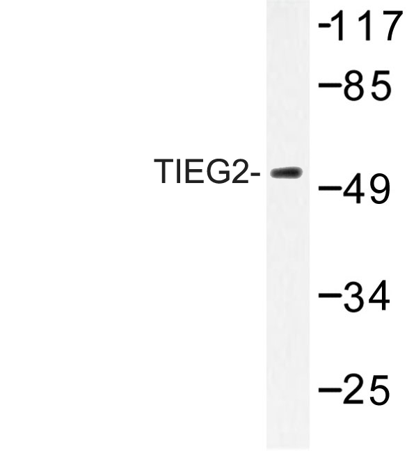 Western blot of TIEG2 (F6) pAb in extracts from 293 cells.