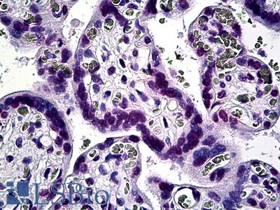 Anti-KLF11 antibody IHC of human placenta. Immunohistochemistry of formalin-fixed, paraffin-embedded tissue after heat-induced antigen retrieval. Antibody LS-B5433 concentration 10 ug/ml.