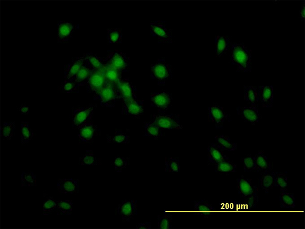 Immunofluorescence of monoclonal antibody to KLF11 on NIH/3T3 cell. [antibody concentration 10 ug/ml]