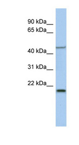 KLF15 antibody LS-C109618 Western blot of Fetal Spleen lysate.