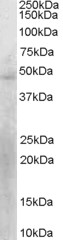 Antibody staining (0.3 ug/ml) of HepG2 lysate (RIPA buffer, 30 ug total protein per lane). Primary incubated for 12 hour. Detected by Western blot of chemiluminescence.