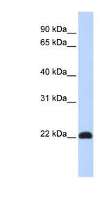 KLF16 antibody LS-C101786 Western blot of Fetal Muscle lysate.