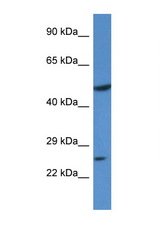 KLF17 antibody LS-C101813 Western blot of 293T Cell lysate. Antibody concentration 1 ug/ml.