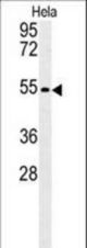 KLF17 Antibody western blot of HeLa cell line lysates (35 ug/lane). The KLF17 antibody detected the KLF17 protein (arrow).