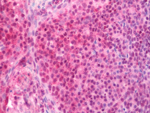 Human Tonsil: Formalin-Fixed, Paraffin-Embedded (FFPE) 