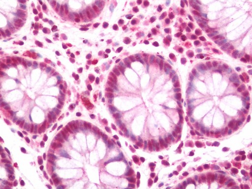 Human Colon: Formalin-Fixed, Paraffin-Embedded (FFPE)
