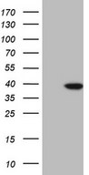 HEK293T cells were transfected with the pCMV6-ENTRY control (Left lane) or pCMV6-ENTRY KLF2 (Right lane) cDNA for 48 hrs and lysed. Equivalent amounts of cell lysates (5 ug per lane) were separated by SDS-PAGE and immunoblotted with anti-KLF2.