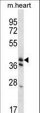 KLF2 Antibody western blot of mouse heart tissue lysates (35 ug/lane). The KLF2 antibody detected the KLF2 protein (arrow).