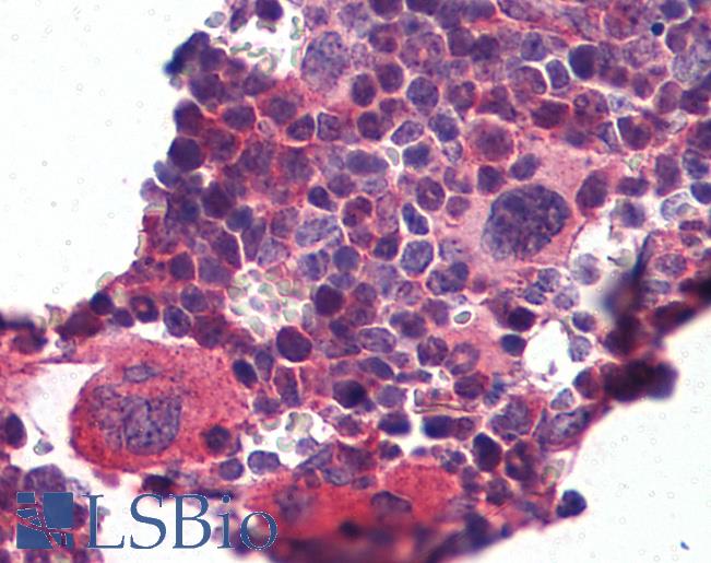 Anti-KLF2 antibody IHC of mouse lymphoid tissue. Immunohistochemistry of formalin-fixed, paraffin-embedded tissue after heat-induced antigen retrieval. Antibody LS-B5627 concentration 5 ug/ml.