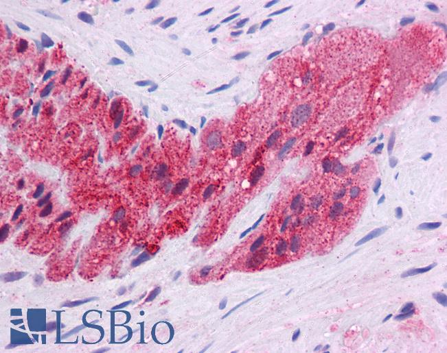 Anti-KLF2 antibody IHC of human colon, myenteric plexus. Immunohistochemistry of formalin-fixed, paraffin-embedded tissue after heat-induced antigen retrieval. Antibody LS-B4570 concentration 5 ug/ml.