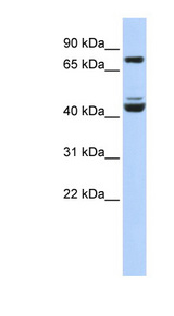 KLF2 antibody LS-B4570 Western blot of 721_B cell lysate.