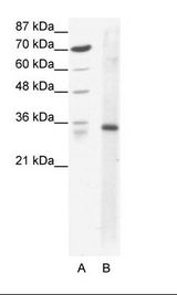 A: Marker, B: HepG2 Cell Lysate