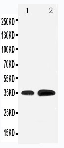 WB of KLF3 antibody. All lanes: Anti-KLF3 at 0.5ug/ml. Lane 1: Rat Testis Tissue Lysate at 40ug. Lane 2: HELA Whole Cell Lysate at 40ug. Predicted bind size: 35KD. Observed bind size: 35KD.
