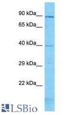 KLF3 antibody Western Blot of 721_B. Antibody dilution: 1 ug/ml.