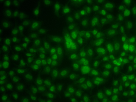 Immunofluorescence blot of A549 cell using KLF3 antibody.