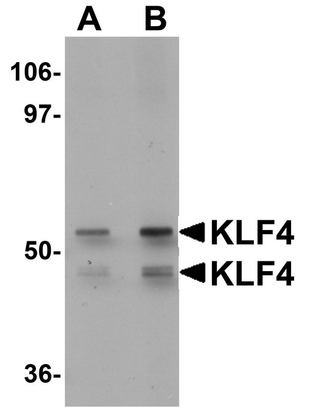 Western blot analysis of KLF4 in human liver tissue lysate with KLF4 antibody at (A) 1 and (B) 2 ug/ml.
