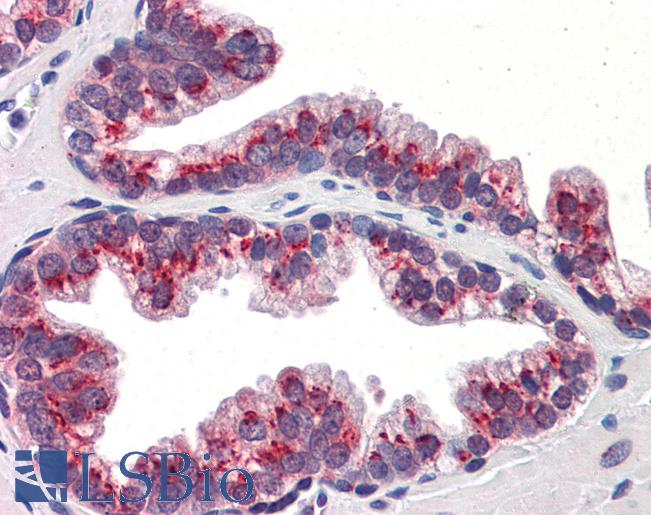 Anti-KLF4 antibody IHC of human prostate. Immunohistochemistry of formalin-fixed, paraffin-embedded tissue after heat-induced antigen retrieval. Antibody LS-B5641 concentration 5 ug/ml.