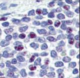 Formalin-fixed and paraffin-embedded human Spleen tissue reacted with KLF4 antibody (N-term C74) , which was peroxidase-conjugated to the secondary antibody, followed by AEC staining. This data demonstrates the use of this antibody for immunohistochemistry; clinical relevance has not been evaluated.