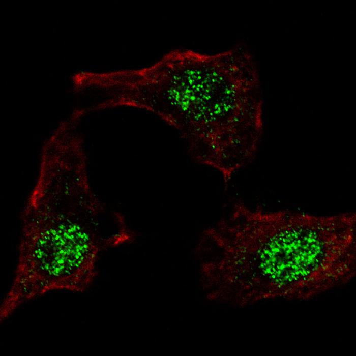 Fluorescent confocal image of HeLa cells stained KLF4 (N-term C74) antibody. HeLa cells were fixed with 4% PFA (20 min), permeabilized with Triton X-100 (0.2%, 30 min), then incubated KLF4 (N-term C74) primary antibody (1:100, 2 h at room temperature). For secondary antibody, Alexa Fluor 488 conjugated donkey anti-rabbit antibody (green) was used (1:1000, 1h). Cytoplasmic actin was counterstained with Alexa Fluor 555 (red) conjugated Phalloidin (5.25 mu M, 25 min). KLF4 immunoreactivity is localized to the nuclei in HeLa cells.