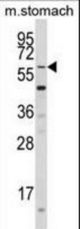 Western blot of KLF4 Antibody (N-term C74) in mouse stomach tissue lysates (35 ug/lane). KLF4 (arrow) was detected using the purified antibody.