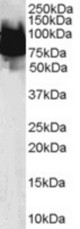 Antibody (0.1 ug/ml) staining of Human Duodenum lysate (35 ug protein in RIPA buffer). Primary incubation was 1 hour. Detected by chemiluminescence.